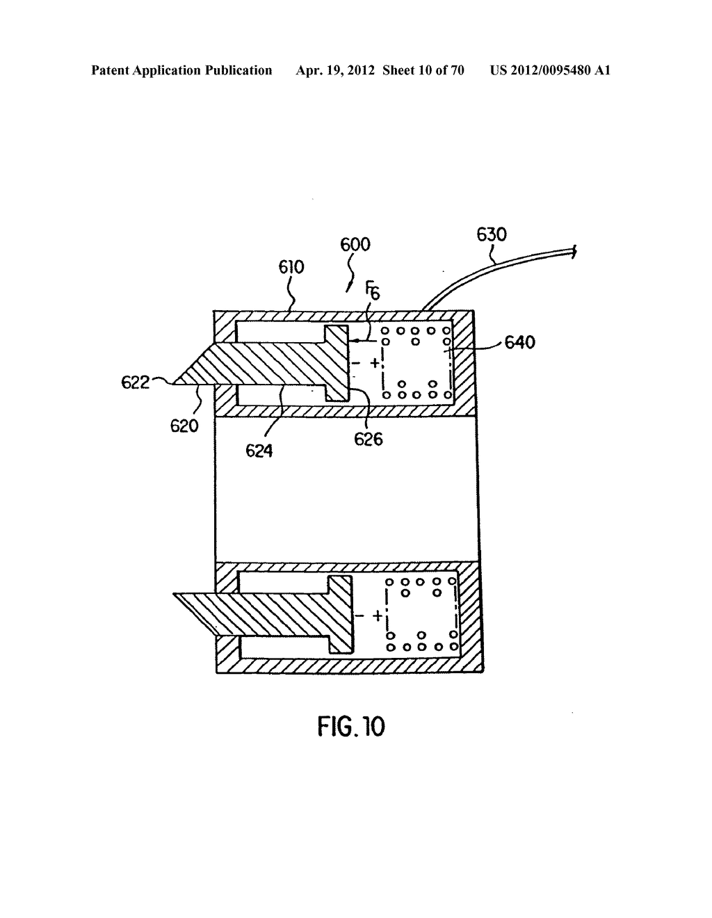 Apparatus and Method for Compressing Body Tissue - diagram, schematic, and image 11