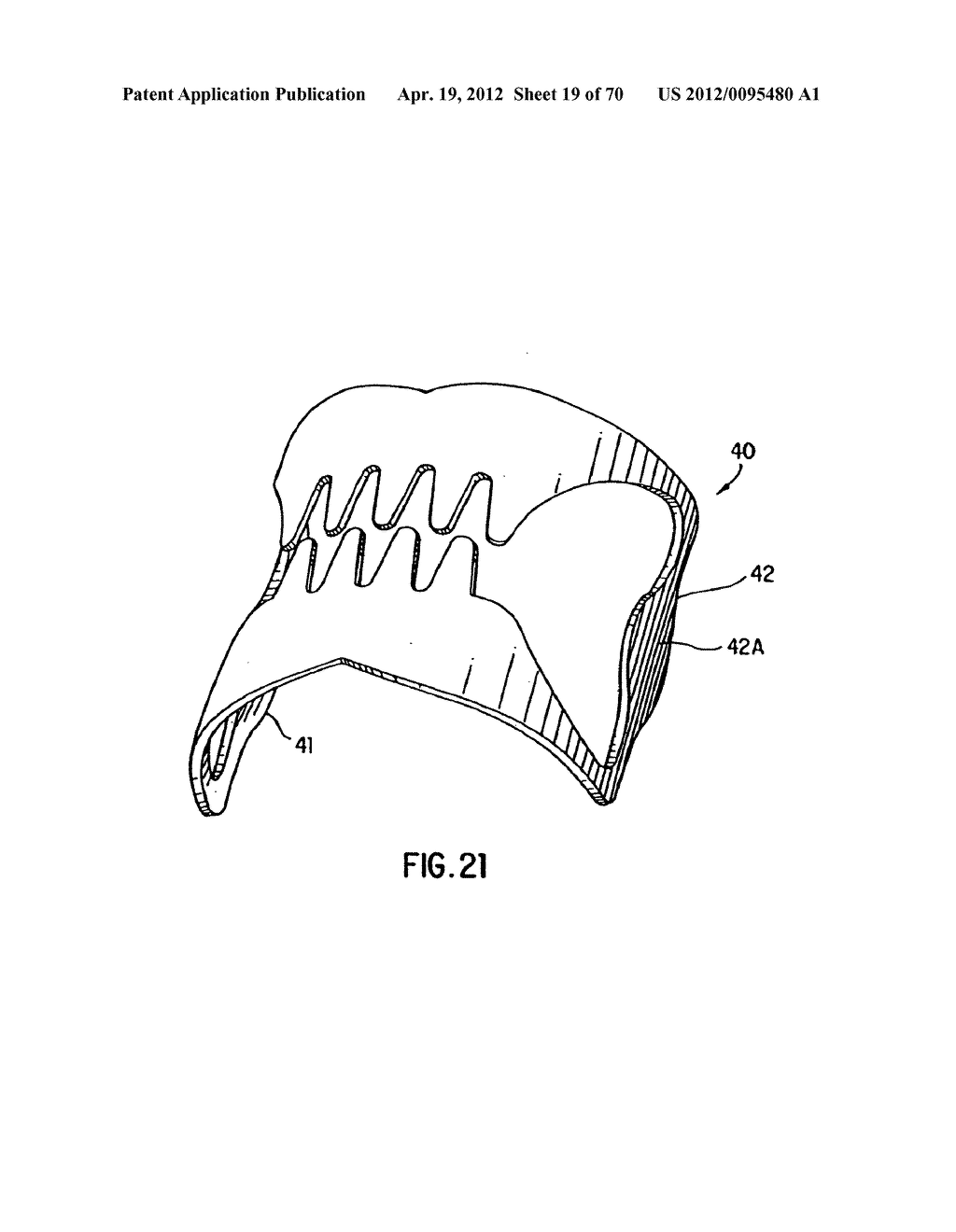 Apparatus and Method for Compressing Body Tissue - diagram, schematic, and image 20