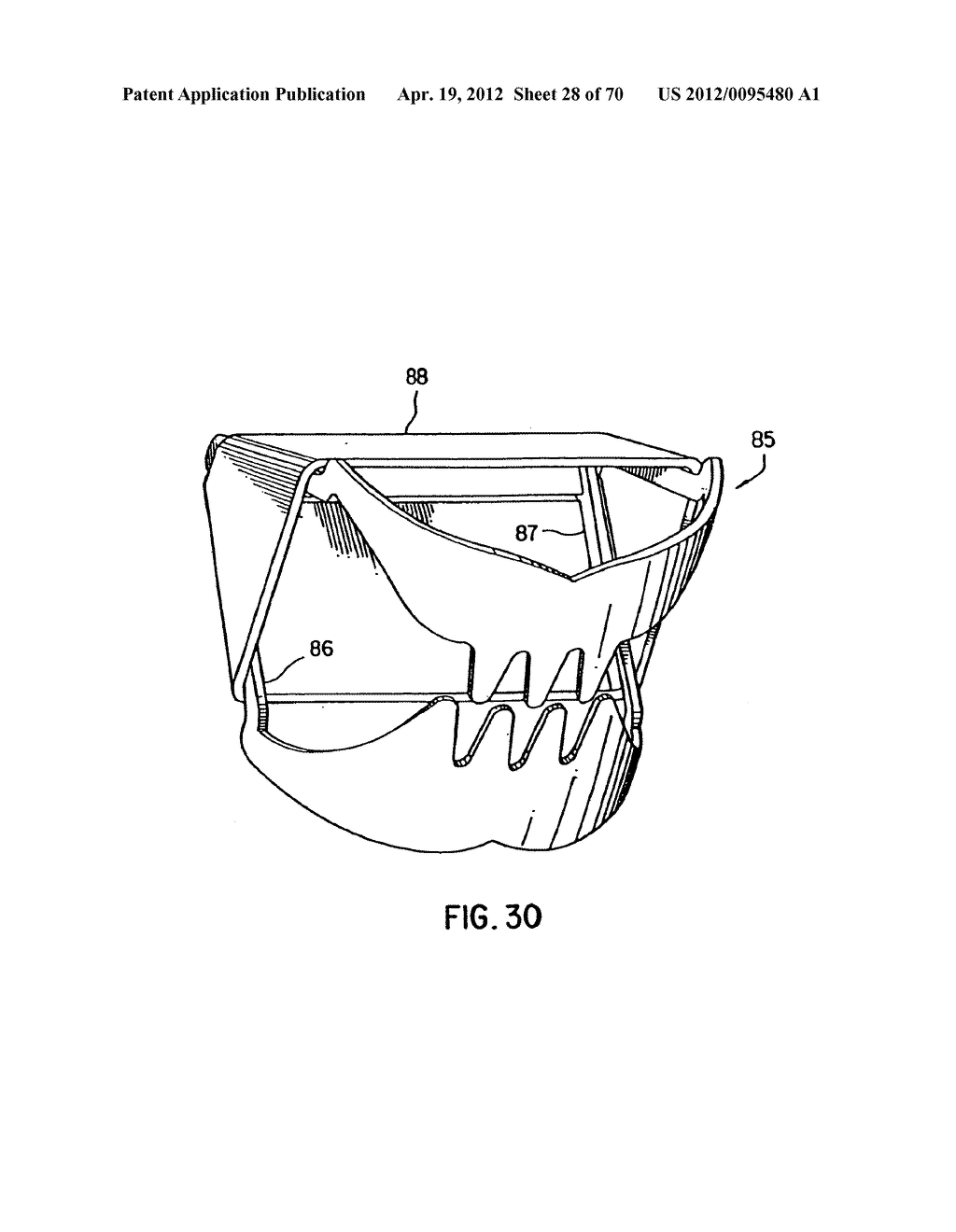 Apparatus and Method for Compressing Body Tissue - diagram, schematic, and image 29