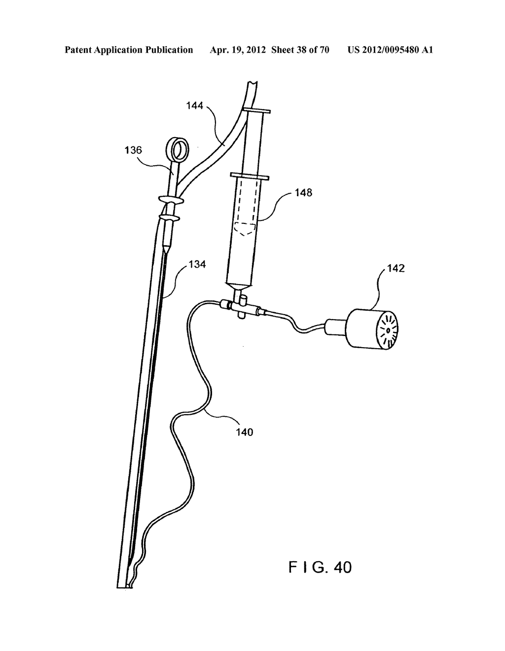 Apparatus and Method for Compressing Body Tissue - diagram, schematic, and image 39