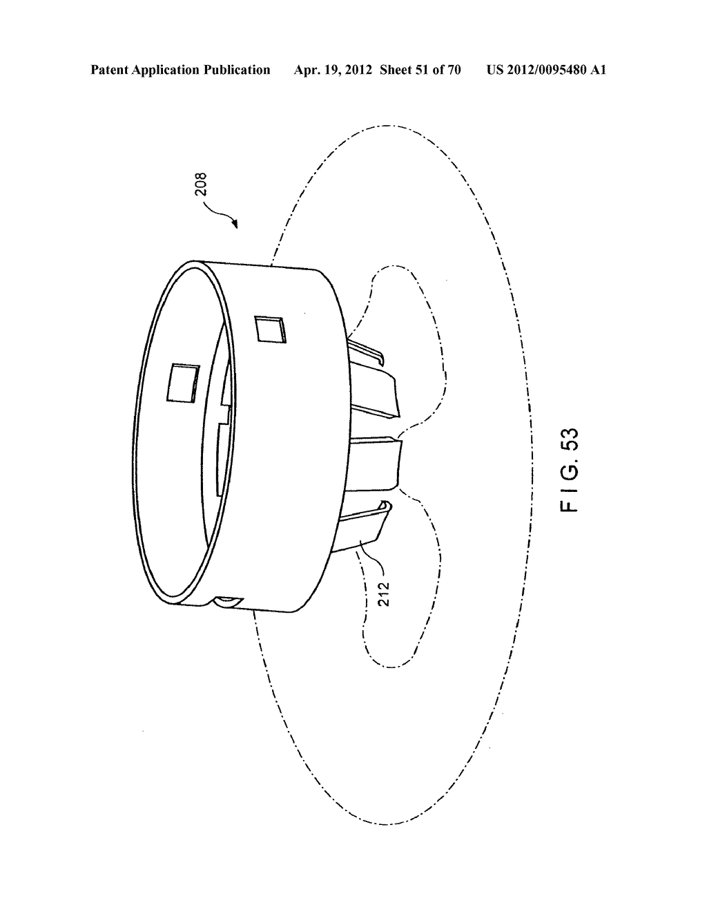 Apparatus and Method for Compressing Body Tissue - diagram, schematic, and image 52