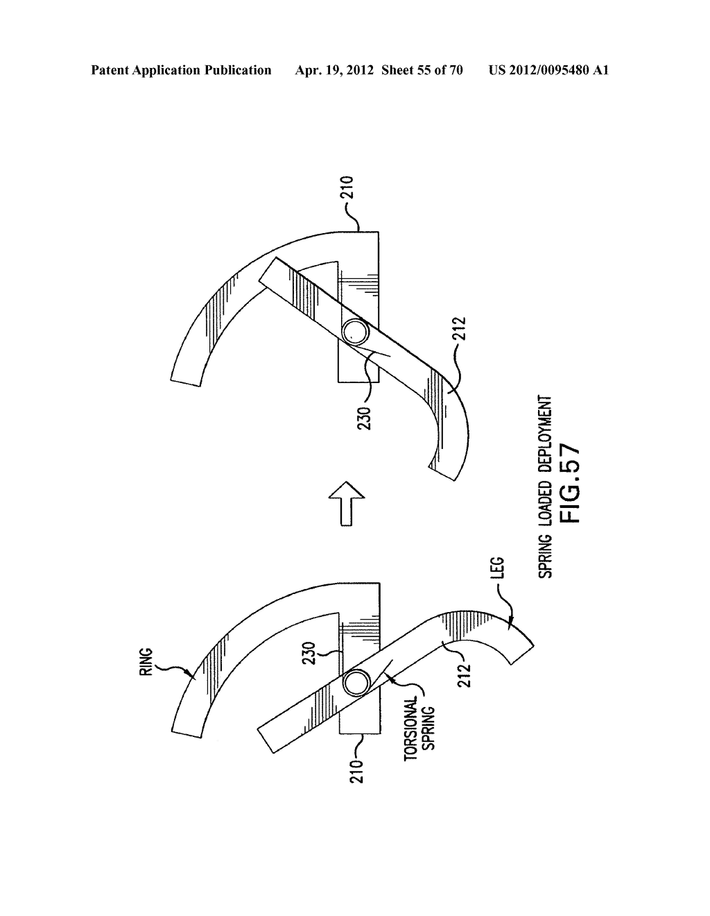 Apparatus and Method for Compressing Body Tissue - diagram, schematic, and image 56