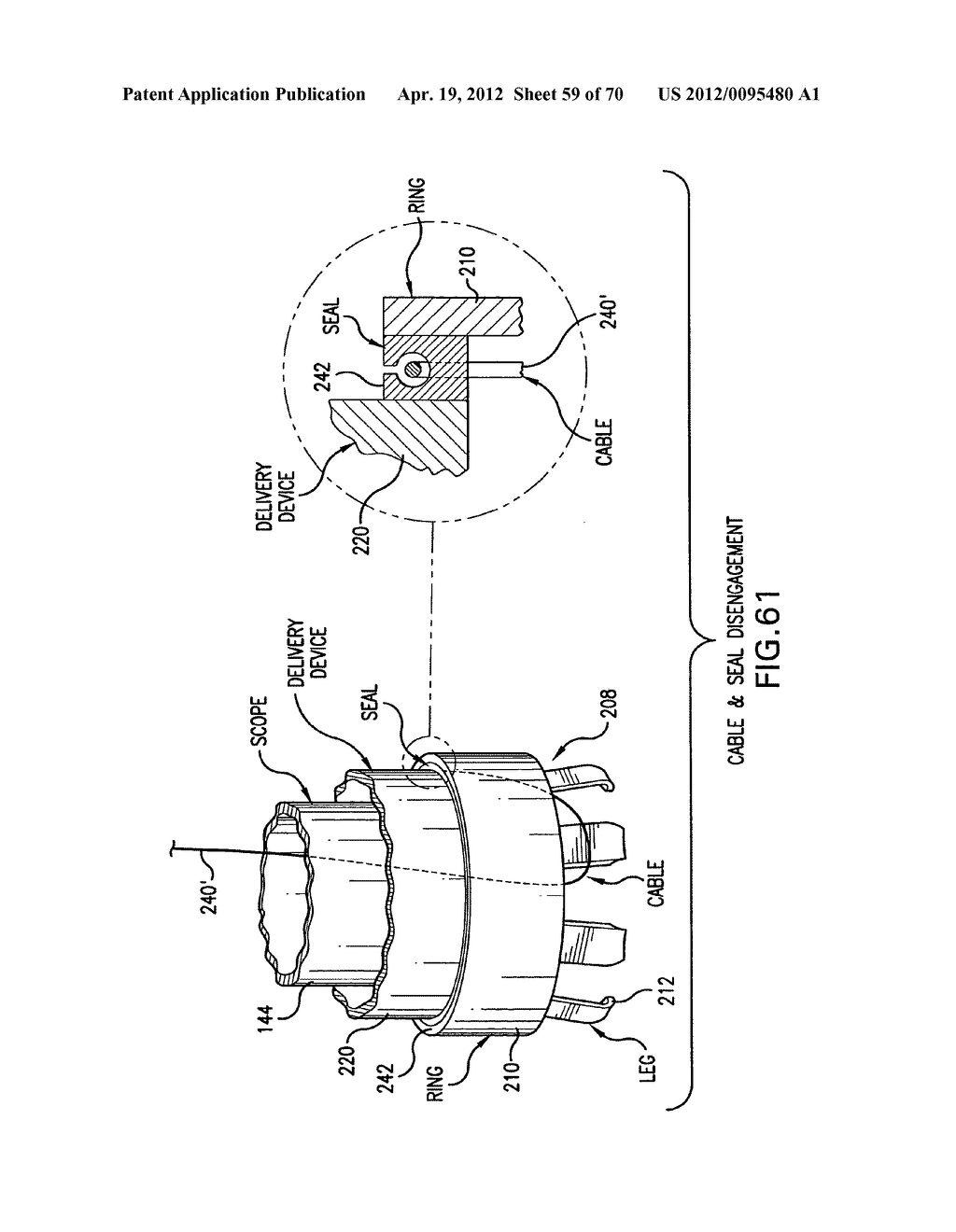 Apparatus and Method for Compressing Body Tissue - diagram, schematic, and image 60