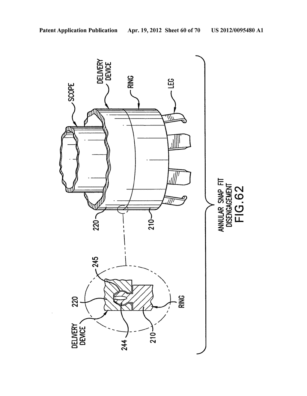 Apparatus and Method for Compressing Body Tissue - diagram, schematic, and image 61