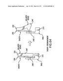 Apparatus and Method for Compressing Body Tissue diagram and image