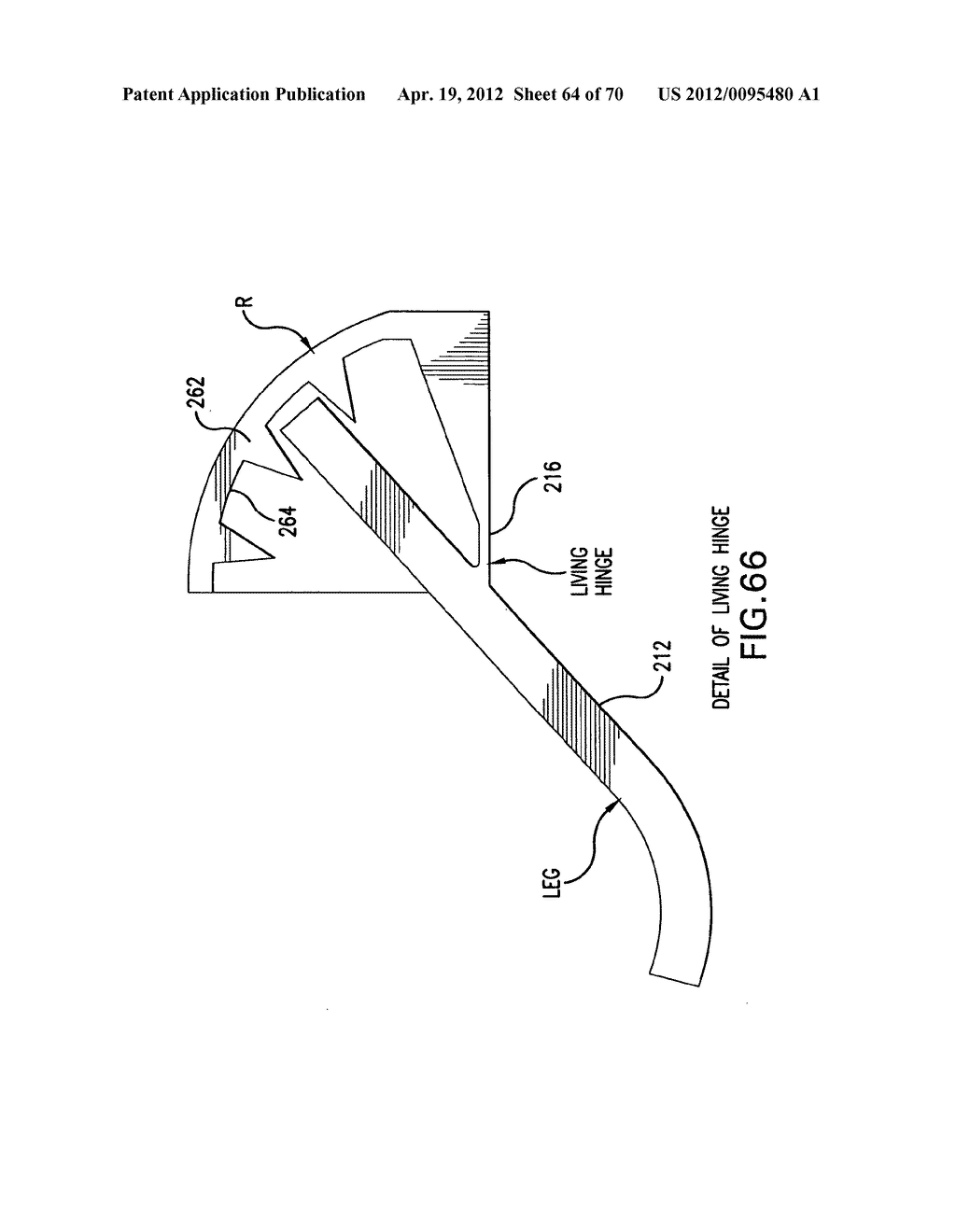 Apparatus and Method for Compressing Body Tissue - diagram, schematic, and image 65