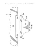 Apparatus and Method for Compressing Body Tissue diagram and image