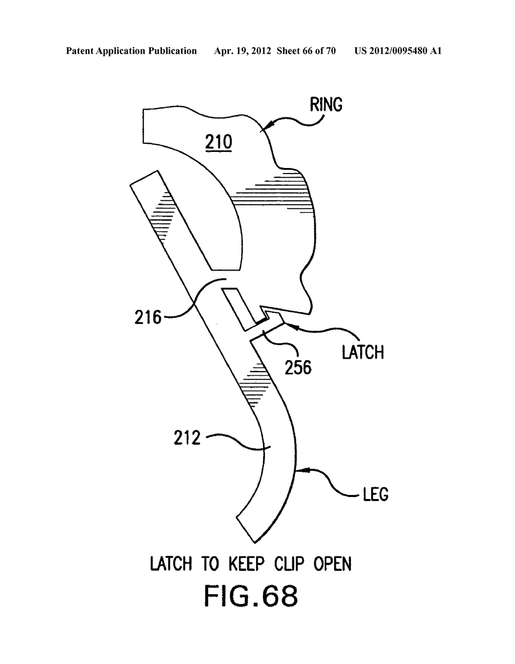 Apparatus and Method for Compressing Body Tissue - diagram, schematic, and image 67