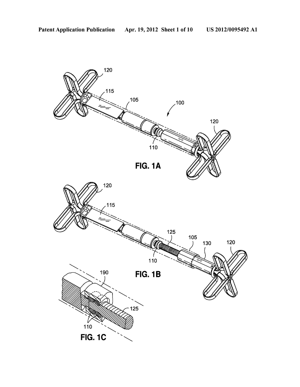 VARIABLE SIZE INTRAGASTRIC IMPLANT DEVICES - diagram, schematic, and image 02