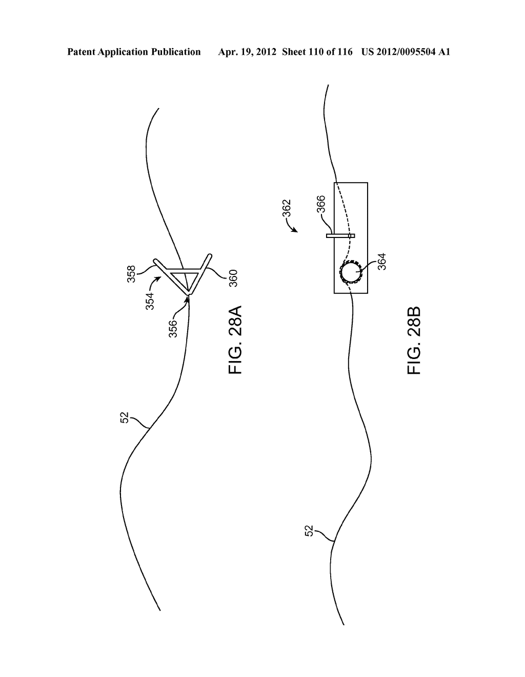 METHOD FOR PROVIDING SURGICAL ACCESS - diagram, schematic, and image 111