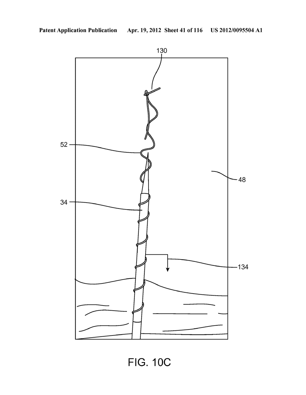 METHOD FOR PROVIDING SURGICAL ACCESS - diagram, schematic, and image 42