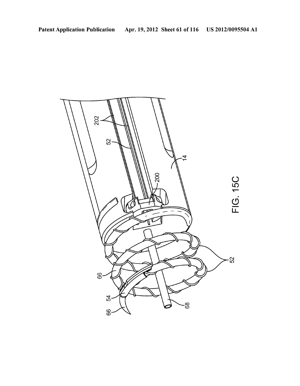 METHOD FOR PROVIDING SURGICAL ACCESS - diagram, schematic, and image 62