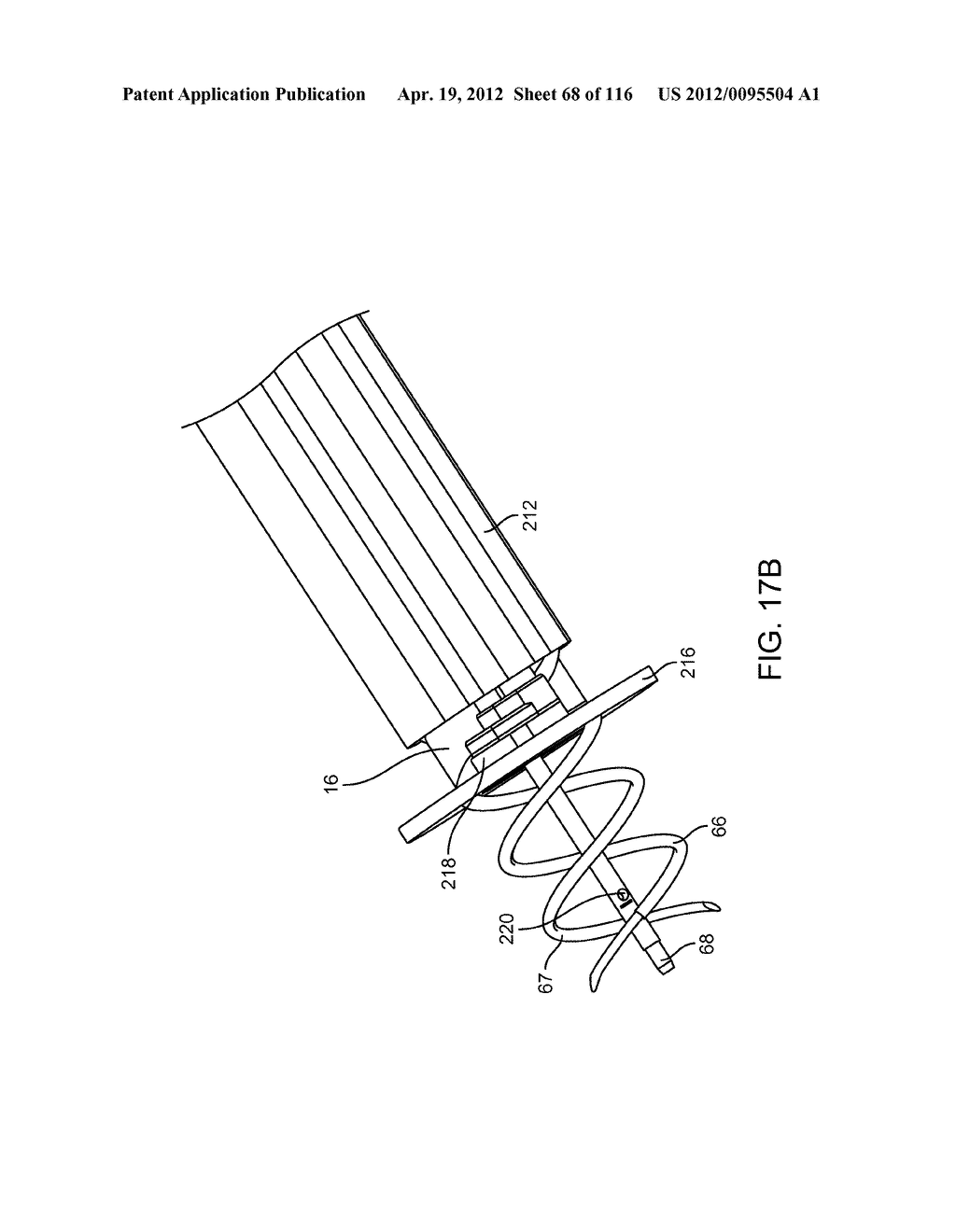 METHOD FOR PROVIDING SURGICAL ACCESS - diagram, schematic, and image 69