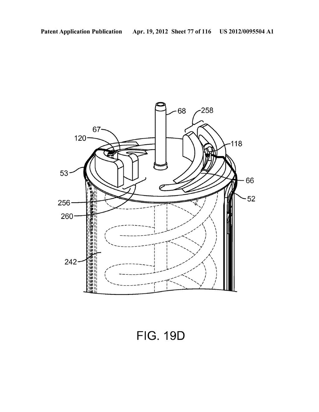 METHOD FOR PROVIDING SURGICAL ACCESS - diagram, schematic, and image 78