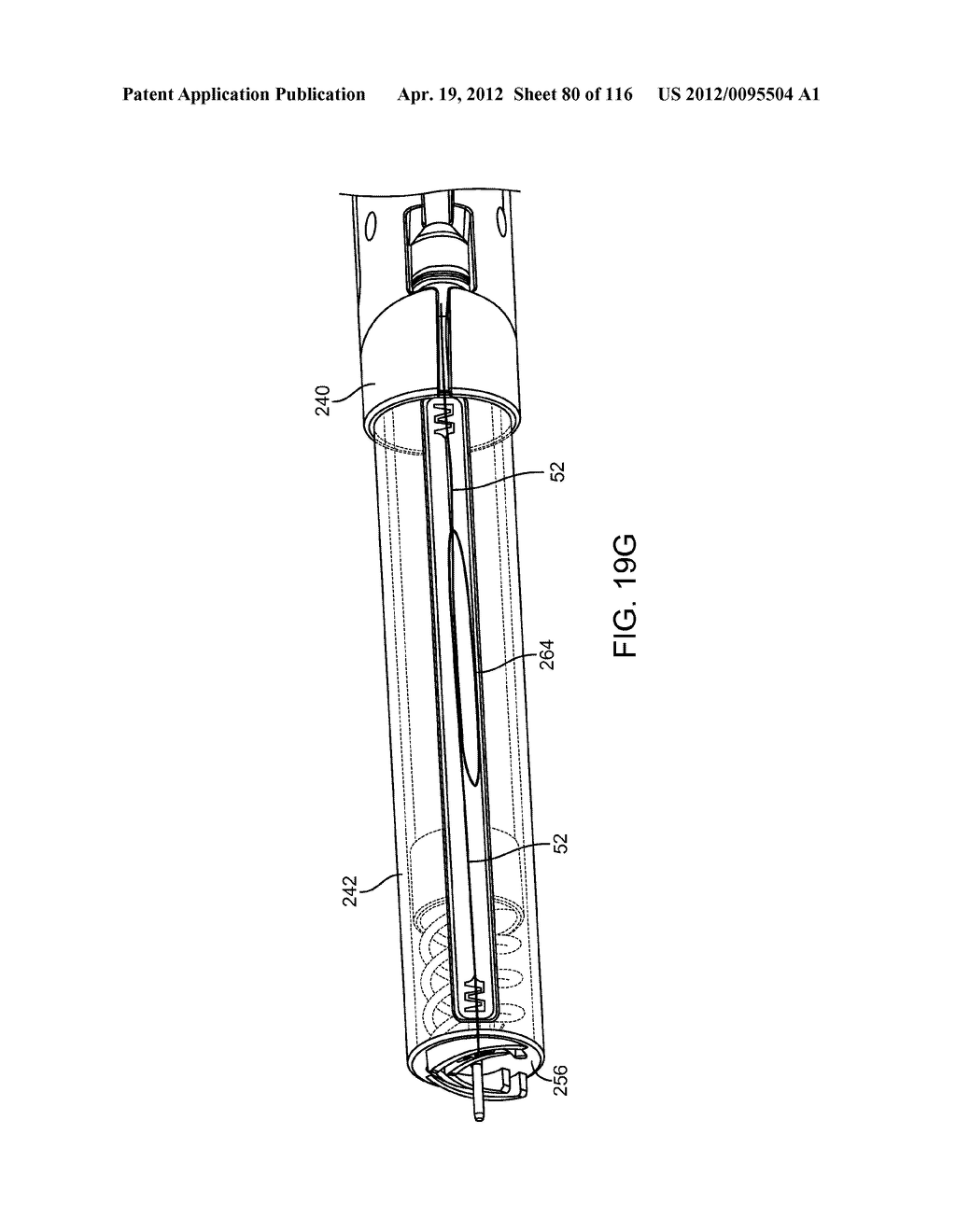 METHOD FOR PROVIDING SURGICAL ACCESS - diagram, schematic, and image 81