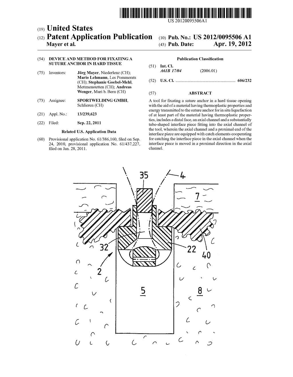 DEVICE AND METHOD FOR FIXATING A SUTURE ANCHOR IN HARD TISSUE - diagram, schematic, and image 01