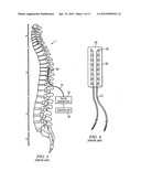 Apparatus and method using near infrared reflectometry to reduce the     effect of positional changes during spinal cord stimulation diagram and image