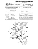 SELF EXPANDABLE MIDDLE EAR IMPLANT FOR TREATING HEARING RELATED DISORDERS diagram and image