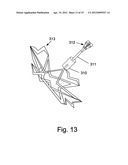 SELF EXPANDABLE MIDDLE EAR IMPLANT FOR TREATING HEARING RELATED DISORDERS diagram and image