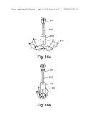 SELF EXPANDABLE MIDDLE EAR IMPLANT FOR TREATING HEARING RELATED DISORDERS diagram and image