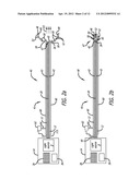 Device For Irradiating An Internal Body Surface diagram and image