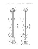 Device For Irradiating An Internal Body Surface diagram and image