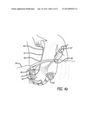 Device For Irradiating An Internal Body Surface diagram and image