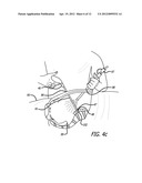 Device For Irradiating An Internal Body Surface diagram and image