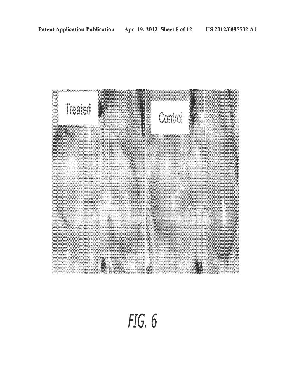 Device For Irradiating An Internal Body Surface - diagram, schematic, and image 09