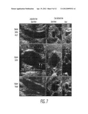 Device For Irradiating An Internal Body Surface diagram and image