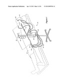 METHOD AND SYSTEM FOR CONTROL OF A PATIENT S BODY TEMPERATURE BY WAY OF A     TRANSLUMINALLY INSERTABLE HEAT EXCHANGE CATHETER diagram and image