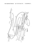 METHOD AND SYSTEM FOR CONTROL OF A PATIENT S BODY TEMPERATURE BY WAY OF A     TRANSLUMINALLY INSERTABLE HEAT EXCHANGE CATHETER diagram and image