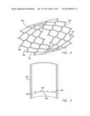 MODULAR GRAFTING SYSTEM AND METHOD diagram and image