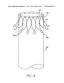 MODULAR GRAFTING SYSTEM AND METHOD diagram and image