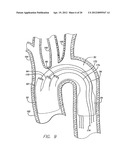 MODULAR GRAFTING SYSTEM AND METHOD diagram and image