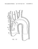 MODULAR GRAFTING SYSTEM AND METHOD diagram and image