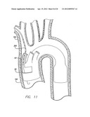 MODULAR GRAFTING SYSTEM AND METHOD diagram and image