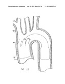 MODULAR GRAFTING SYSTEM AND METHOD diagram and image