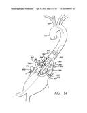 MODULAR GRAFTING SYSTEM AND METHOD diagram and image