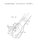 MODULAR GRAFTING SYSTEM AND METHOD diagram and image