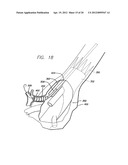 MODULAR GRAFTING SYSTEM AND METHOD diagram and image