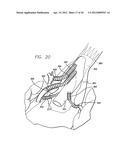 MODULAR GRAFTING SYSTEM AND METHOD diagram and image