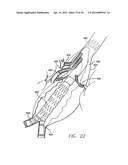 MODULAR GRAFTING SYSTEM AND METHOD diagram and image