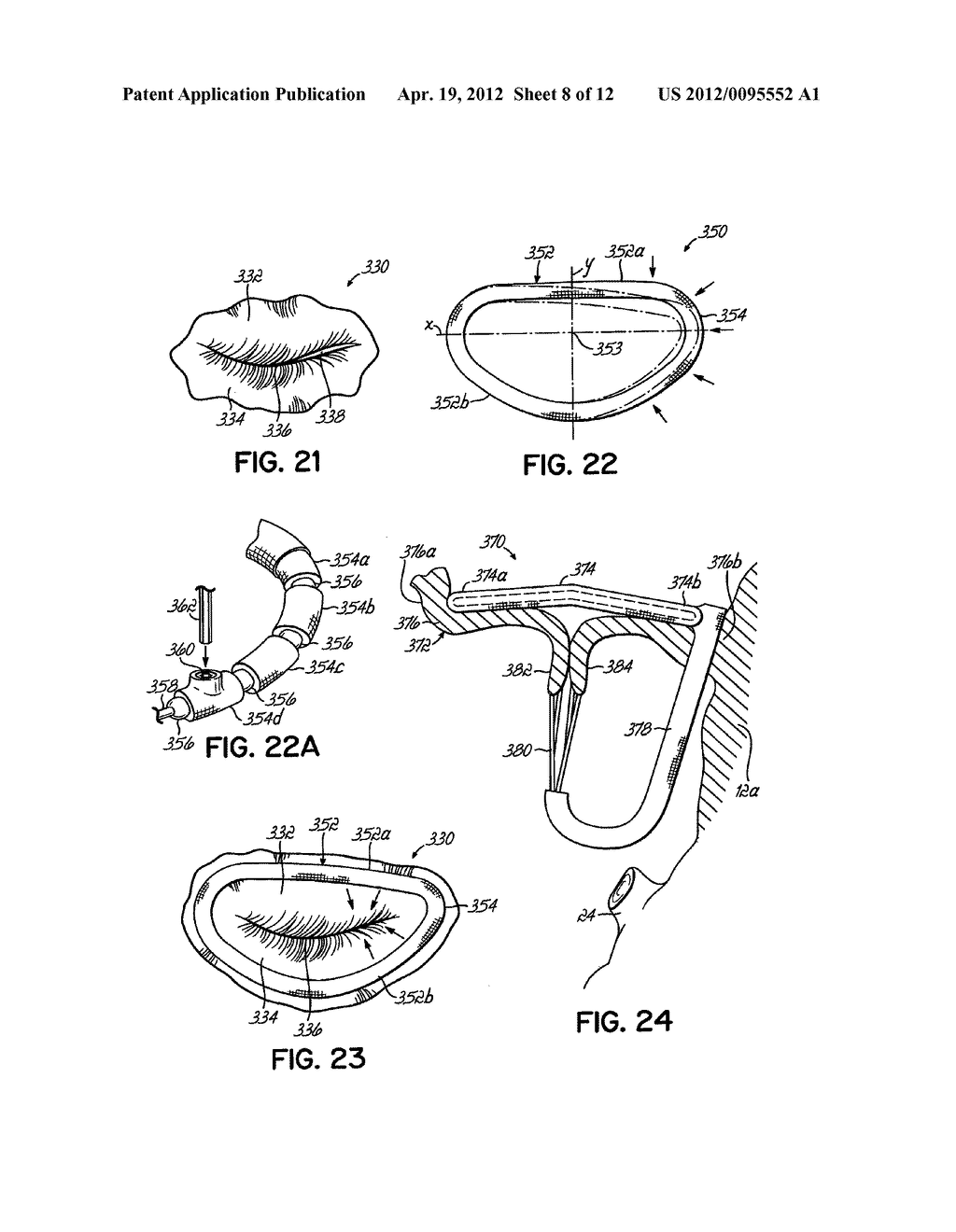 HEART VALVE REPAIR APPARATUS AND METHODS - diagram, schematic, and image 09