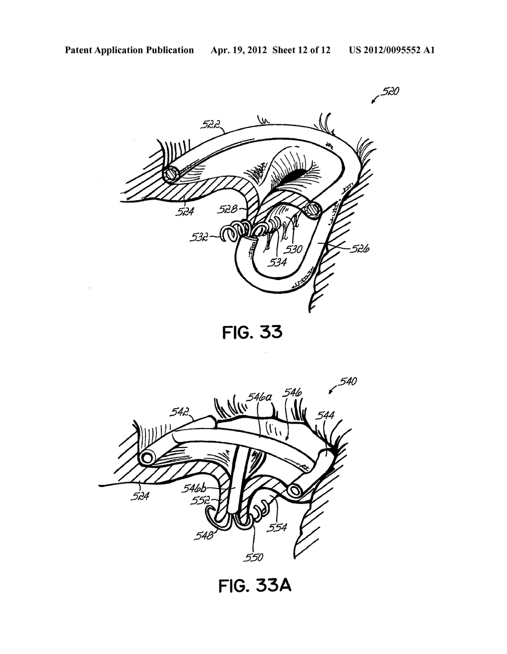 HEART VALVE REPAIR APPARATUS AND METHODS - diagram, schematic, and image 13