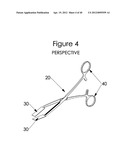 INTERVERTEBRAL SPINAL IMPLANT, INSTALLATION DEVICE AND SYSTEM diagram and image