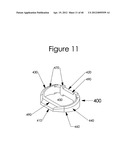 INTERVERTEBRAL SPINAL IMPLANT, INSTALLATION DEVICE AND SYSTEM diagram and image