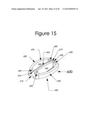 INTERVERTEBRAL SPINAL IMPLANT, INSTALLATION DEVICE AND SYSTEM diagram and image