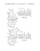 ANTERIOR CRUCIATE LIGAMENT SUBSTITUTING KNEE IMPLANTS diagram and image