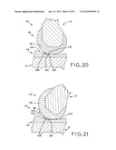 ANTERIOR CRUCIATE LIGAMENT SUBSTITUTING KNEE IMPLANTS diagram and image